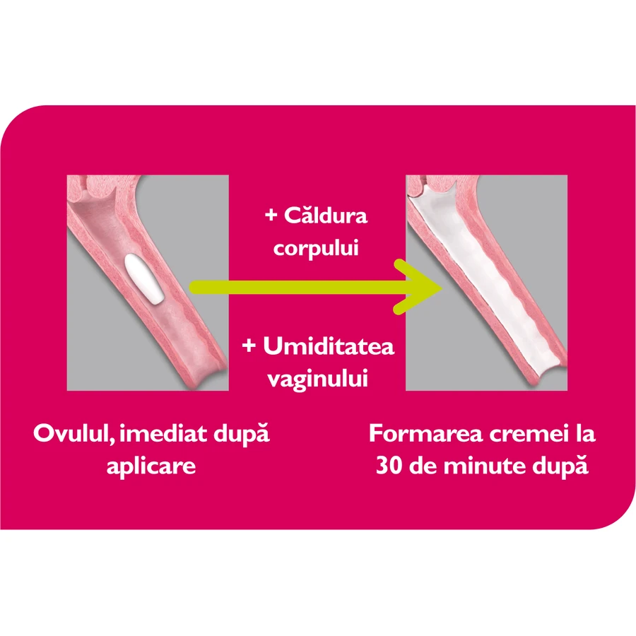 Vagisan Milchsäure-Vaginalzäpfchen, 2 × 7 Stück, Vagisan